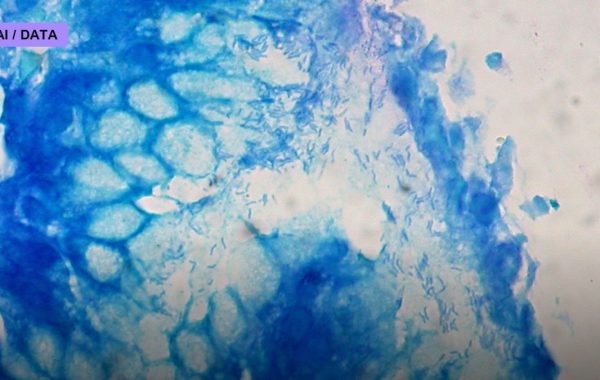 Liquid Biopsies Hunt Cancer in a Blood Draw