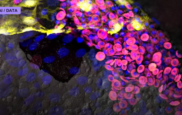 Embryo Models Built Without Egg or Sperm