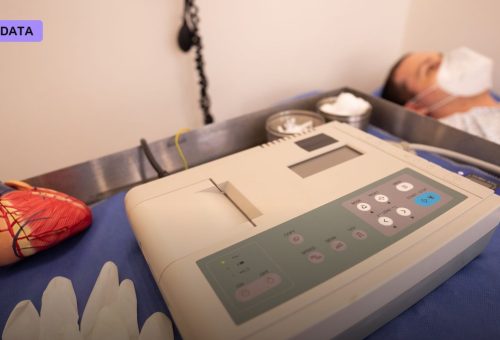 New AI Model Reads Heart Disease Risk From an ECG Using 91% Less Training Data