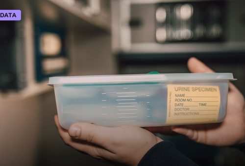 MIT Used AI to Design Cancer Sensors That Turn Up in a Pregnancy-Style Urine Test