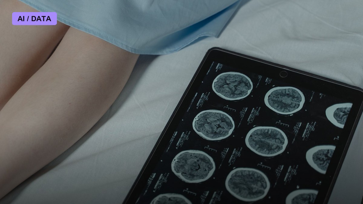 Illinois Hospital System Rolls Out AI Stroke Imaging to Every Emergency Room in Its Network