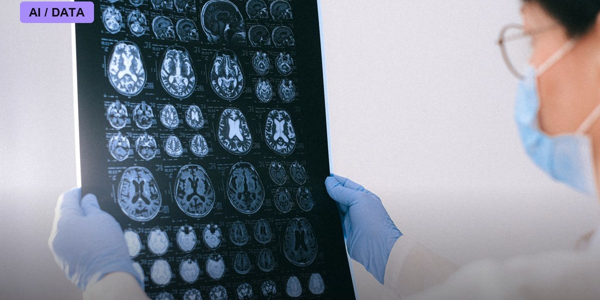 Cleveland Clinic Puts Siemens' AI Prostate MRI Tool Through a Clinical Trial Before Trusting It at the Bedside