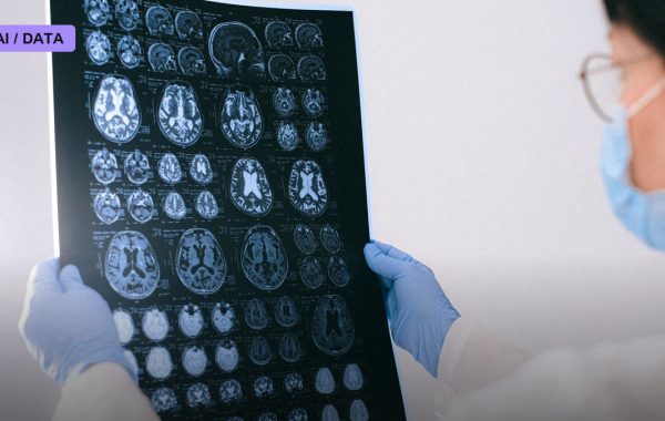 Cleveland Clinic Puts Siemens' AI Prostate MRI Tool Through a Clinical Trial Before Trusting It at the Bedside