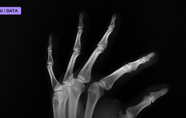 Records Reveal Medicare's AI Prior-Authorization Pilot Denied Over 20,000 Claims and Missed Its Own 72-Hour Rule