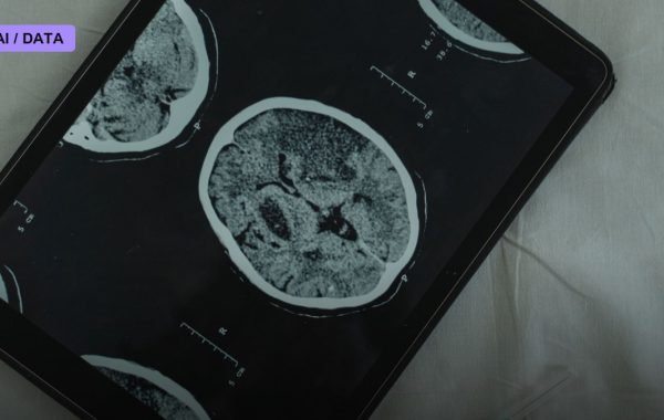 OSF HealthCare Expands AI-Powered Stroke Detection to Rural Illinois Hospitals