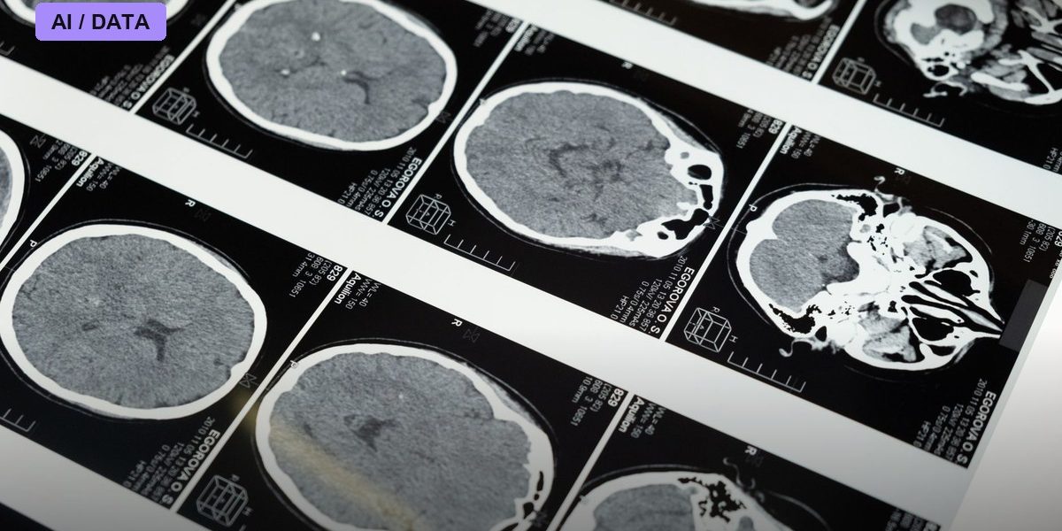 Yale New Haven Health Hands Rad AI the Keys to 700,000 Annual Scans