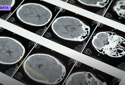 Yale New Haven Health Hands Rad AI the Keys to 700,000 Annual Scans
