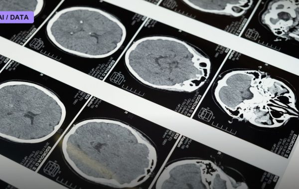 Yale New Haven Health Hands Rad AI the Keys to 700,000 Annual Scans