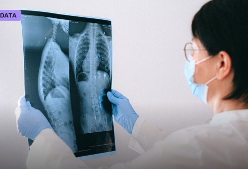 The FDA Has Now Cleared More Than 1,600 AI Medical Devices — and Radiology Still Dominates the List