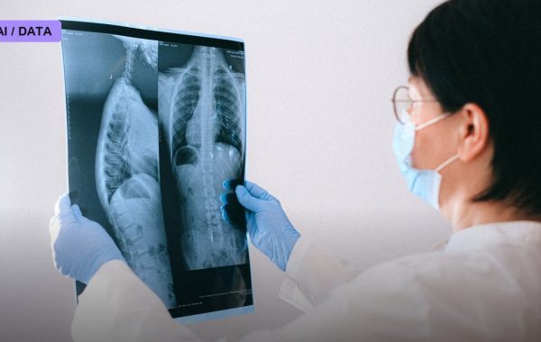 The FDA Has Now Cleared More Than 1,600 AI Medical Devices — and Radiology Still Dominates the List