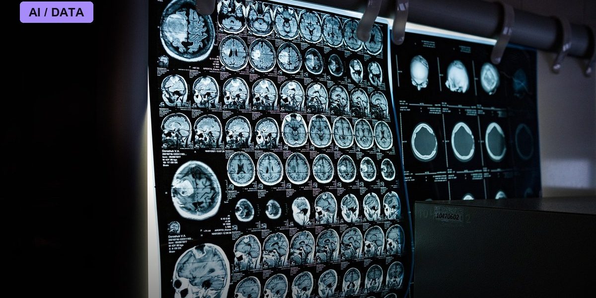 Nearly Half a Million Women in One Study Show What AI Actually Adds to Breast Cancer Screening