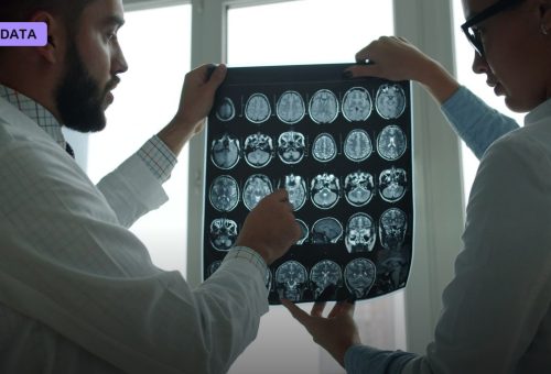 Viz.ai's Stroke-Spotting Software Is Already Saving Minutes at Two California Hospitals