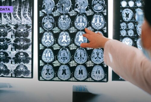 FDA Clears AI Tool That Predicts Breast Cancer's Return Years Before It Happens