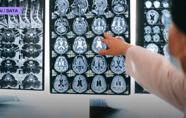 FDA Clears AI Tool That Predicts Breast Cancer's Return Years Before It Happens