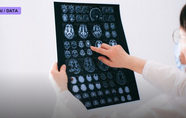 AI Cuts Stroke Diagnosis Time From an Hour to Two Minutes at Apollo Hospitals
