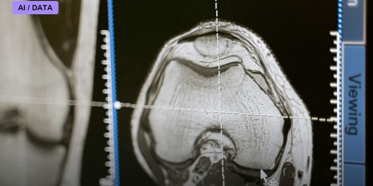 FDA-Cleared AI Tool Predicts Whether Breast Cancer Will Return Using Scans Patients Already Have
