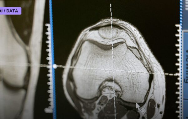 FDA-Cleared AI Tool Predicts Whether Breast Cancer Will Return Using Scans Patients Already Have