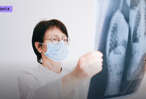 Medicare Now Reimburses an AI Tool That Flags High-Risk Lung Nodules