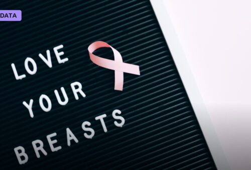 Swedish MASAI Trial Finds AI-Supported Mammography Catches More Cancers Without More False Alarms