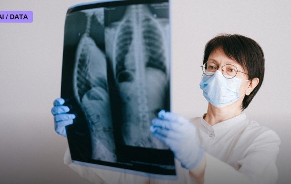 An AI Looked at 420,000 Routine Chest X-Rays and Found a New Way to Predict Who Dies Early