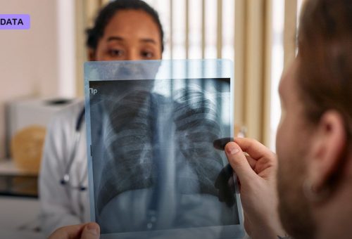 Your Next Chest X-Ray Could Quietly Flag Osteoporosis Years Before a Bone Scan Would