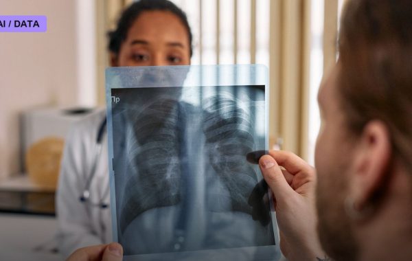 Your Next Chest X-Ray Could Quietly Flag Osteoporosis Years Before a Bone Scan Would