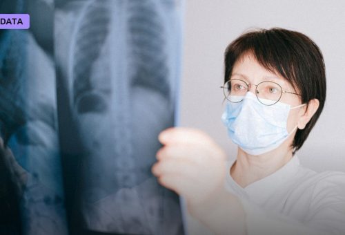 Ethiopia Rolled Out AI Chest X-Ray Screening in 225 Clinics. A New Report Shows Where It Actually Found TB