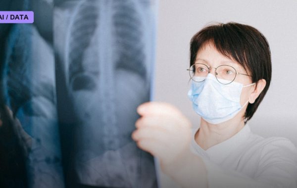 Ethiopia Rolled Out AI Chest X-Ray Screening in 225 Clinics. A New Report Shows Where It Actually Found TB